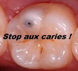 Stop aux caries !